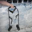 The girl's leg braces